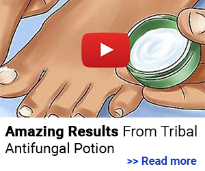 Read more amazing results from tribal antifungal potion