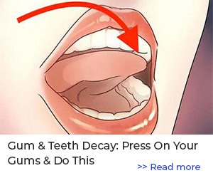 Let This Sweet Melt Under Your Tongue To Fix Gum & Tooth Decay