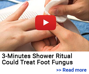 Read more about 3 munites shower ritual could treat foot fungus
